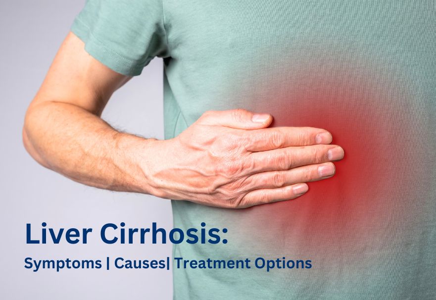 Liver Cirrhosis: Symptoms, Causes, and Treatment Options